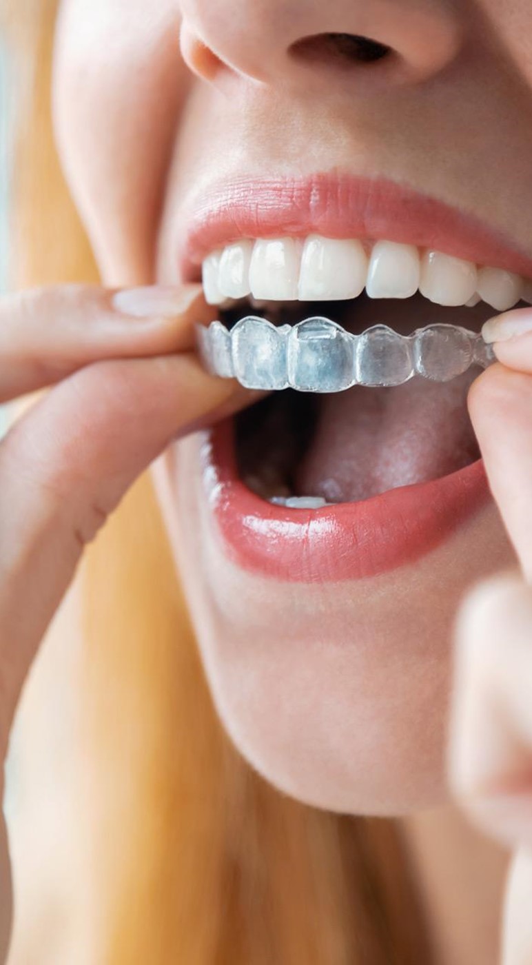 Centro autorizado de Ortodoncia Invisalign