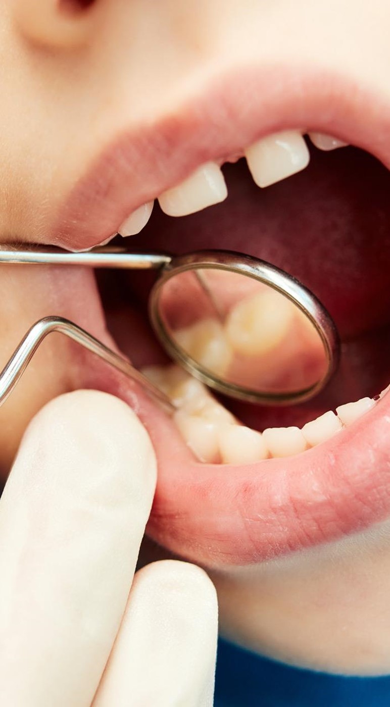 Cuidado dental para los más pequeños